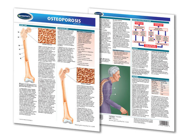 Osteoporosis Guide - Health & Medical Quick Reference Guide