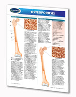 Osteoporosis Guide - Health & Medical Quick Reference Guide