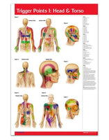 Trigger Point acupuncture poster